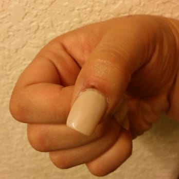 Neat Nails - Two days later my thumb is still swollen from my cuticle being cut. - Nail Salons Near Me - Tucson, Arizona Neat Nails - Two days later my thumb is still swollen from my cuticle being cut. - Nail Salons Near Me - Tucson, Arizona
