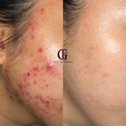 Glo By Grace Skincare Studio
