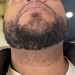 Laser Beamer Skincare