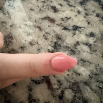 Pink Polish - Bleeding cuticle - Nail Salons Near Me - Ruston, Washington Pink Polish - Bleeding cuticle - Nail Salons Near Me - Ruston, Washington