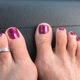 Bad pedicure
