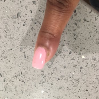 Lee's Nails - Infected finger. First set of nails in 2 years  please don't go to this establishment. - Nail Salons Near Me - Houston, Texas