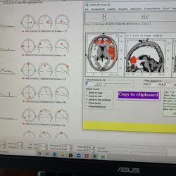 Elite Physiology - Part of a report