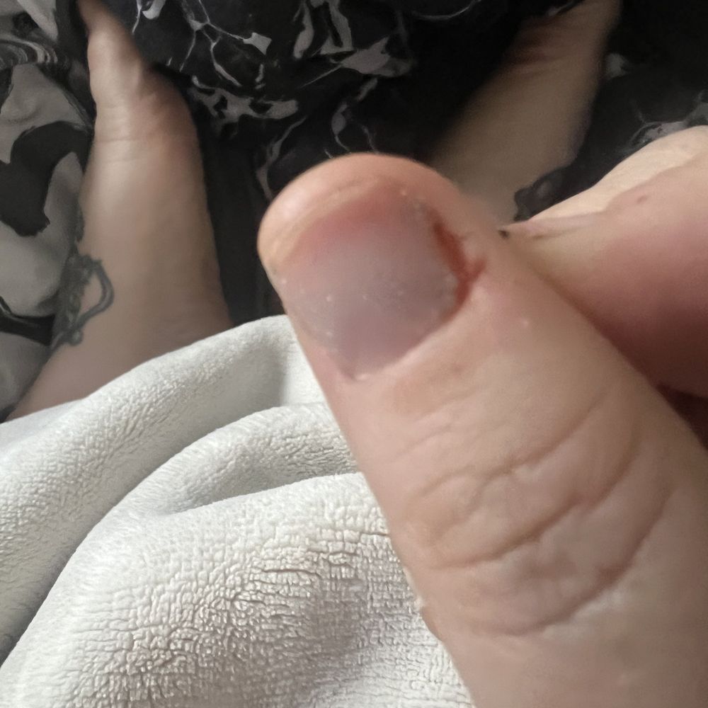Image Nails - Ouch and how I left the store - Nail Salons Near Me - Brighton, Colorado Image Nails - Ouch and how I left the store - Nail Salons Near Me - Brighton, Colorado