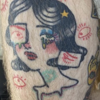 Neoderma - Tattoo pre removal - Medical Spas Near Me - Anaheim, California
