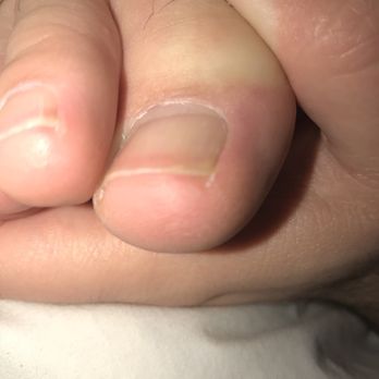 Modern Nails - Thanks for the ingrowns. - Nail Salons Near Me - Frisco, Texas
