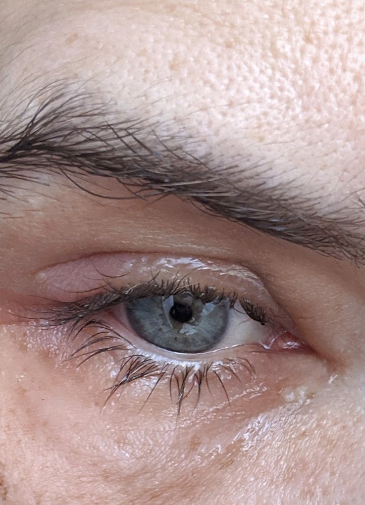 ANTHONY PANARIELLO, MD PALISADE EYE Updated October 2024 203