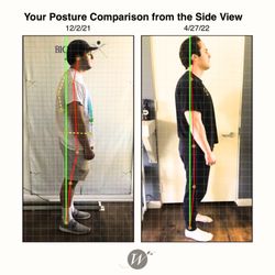 Wellness Choice - Amazing before and after. He looks younger just by correcting his posture!