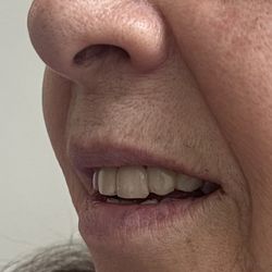 Ultra Dental