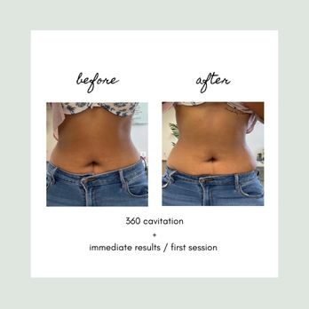 Chelly Jae Aesthetics - Body Contouring Near Me Chelly Jae Aesthetics - Body Contouring Near Me