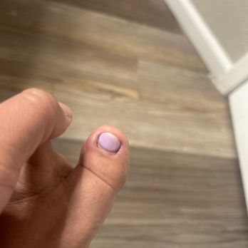 D'Vine Nail Spa - Update my toe has gotten worse and they refuse to do anything about it. - Nail Salons Near Me - El Paso, Texas D'Vine Nail Spa - Update my toe has gotten worse and they refuse to do anything about it. - Nail Salons Near Me - El Paso, Texas