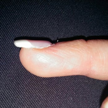Nail Place - This is what my pricey pink & white set looks like.... Ridges, bumps & already lifting off the nail..worst ever. Won't return. - Nail Salons Near Me - Orlando, Florida Nail Place - This is what my pricey pink & white set looks like.... Ridges, bumps & already lifting off the nail..worst ever. Won't return. - Nail Salons Near Me - Orlando, Florida