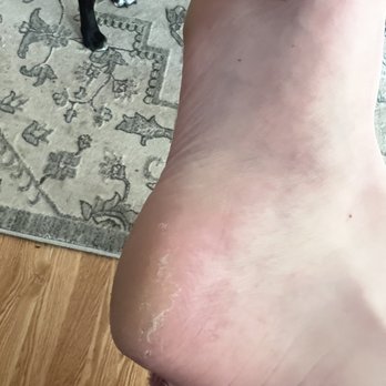 Progress Nails & Spa - Heel callus - Nail Salons Near Me - Beaverton, Oregon