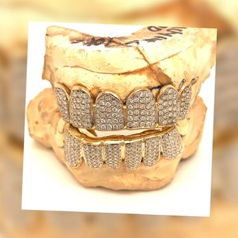 Seattle Gold Grills - 8 top 8 bottom fully diamond flooded set. Each tooth covered in pave set VVs quality diamonds! - Jewelry Near Me - Renton, Washington Seattle Gold Grills - 8 top 8 bottom fully diamond flooded set. Each tooth covered in pave set VVs quality diamonds! - Jewelry Near Me - Renton, Washington