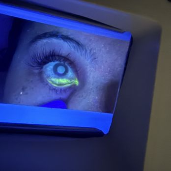 Jenny Beauty Lashes - Glue in the eye, chemical burn - Eyelash Service Near Me - Downey, California Jenny Beauty Lashes - Glue in the eye, chemical burn - Eyelash Service Near Me - Downey, California