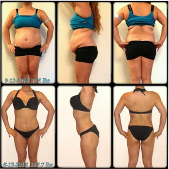 MediPro Holistic Health - Ideal Protein Before and After. 175 lbs to 117 lbs. Started Ideal Protein Jan. 2015 to June 2015 - Acupuncture Near Me - Beaverton, Oregon MediPro Holistic Health - Ideal Protein Before and After. 175 lbs to 117 lbs. Started Ideal Protein Jan. 2015 to June 2015 - Acupuncture Near Me - Beaverton, Oregon