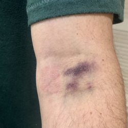 White Plains Urgent Care