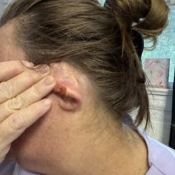 Teche Dermatologic Surgery Center