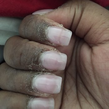 Lovely Nails - Look at my fingers after going here. I don't know what to do!!! - Nail Salons Near Me - Capitol Heights, Maryland Lovely Nails - Look at my fingers after going here. I don't know what to do!!! - Nail Salons Near Me - Capitol Heights, Maryland