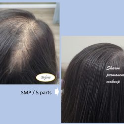 Sharon Permanent Makeup - Buena Park - Bald Cover_Hair Loss_SMP