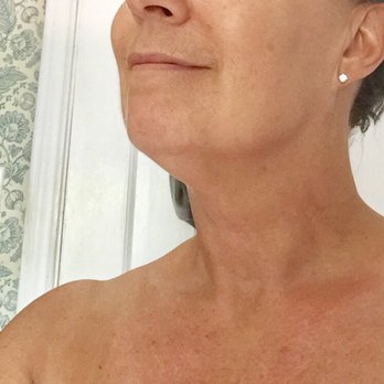 Soleil Airbrush Tanning - After spray, before rinse - Spray Tanning Near Me - Oklahoma City, Oklahoma