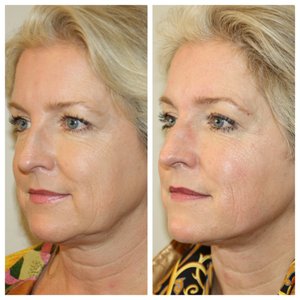 Michael Zarrabi, MD on Yelp