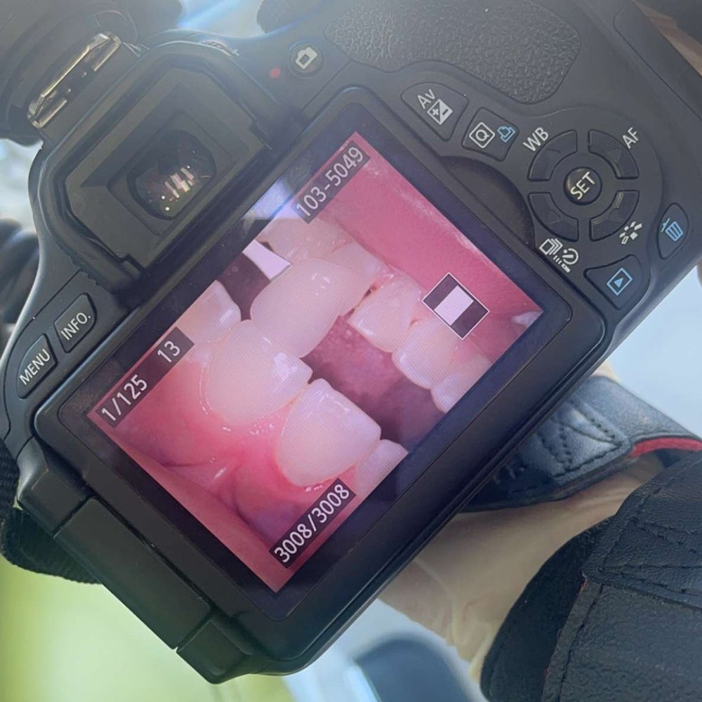 Smile Tijuana Dentist - Teeth whitening - General Dentistry Near Me - Tijuana, BCN Smile Tijuana Dentist - Teeth whitening - General Dentistry Near Me - Tijuana, BCN