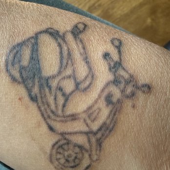 Reno Tattoo Removal - after 3 sessions - Tattoo Removal Near Me - Reno, Nevada Reno Tattoo Removal - after 3 sessions - Tattoo Removal Near Me - Reno, Nevada