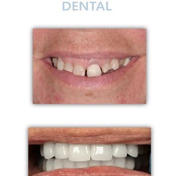 Kwon Dental - We create beautiful smiles! - General Dentistry Near Me - Dallas, Texas Kwon Dental - We create beautiful smiles! - General Dentistry Near Me - Dallas, Texas