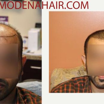 Modena Hair Institute - Hair Loss Centers Near Me - Henderson, Nevada Modena Hair Institute - Hair Loss Centers Near Me - Henderson, Nevada