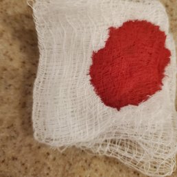 huge bleed . this is after 30 minutes of test. huge bleed . this is after 30 minutes of test.