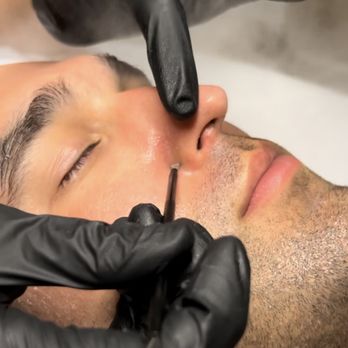 Emerald Aesthetics - Facial - Medical Spas Near Me - Pensacola, Florida