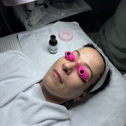 NATURA Hair Removal & Skin Care - Peeling facials