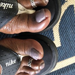 No one should ever be subjected to toenails cut this short.