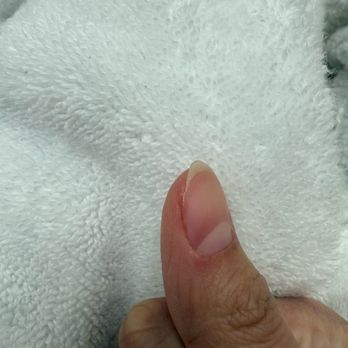 Color Nails & Spa - Nails after dip mistake removed show how deeply into my nail beds the filing went - Nail Salons Near Me - Vacaville, California Color Nails & Spa - Nails after dip mistake removed show how deeply into my nail beds the filing went - Nail Salons Near Me - Vacaville, California