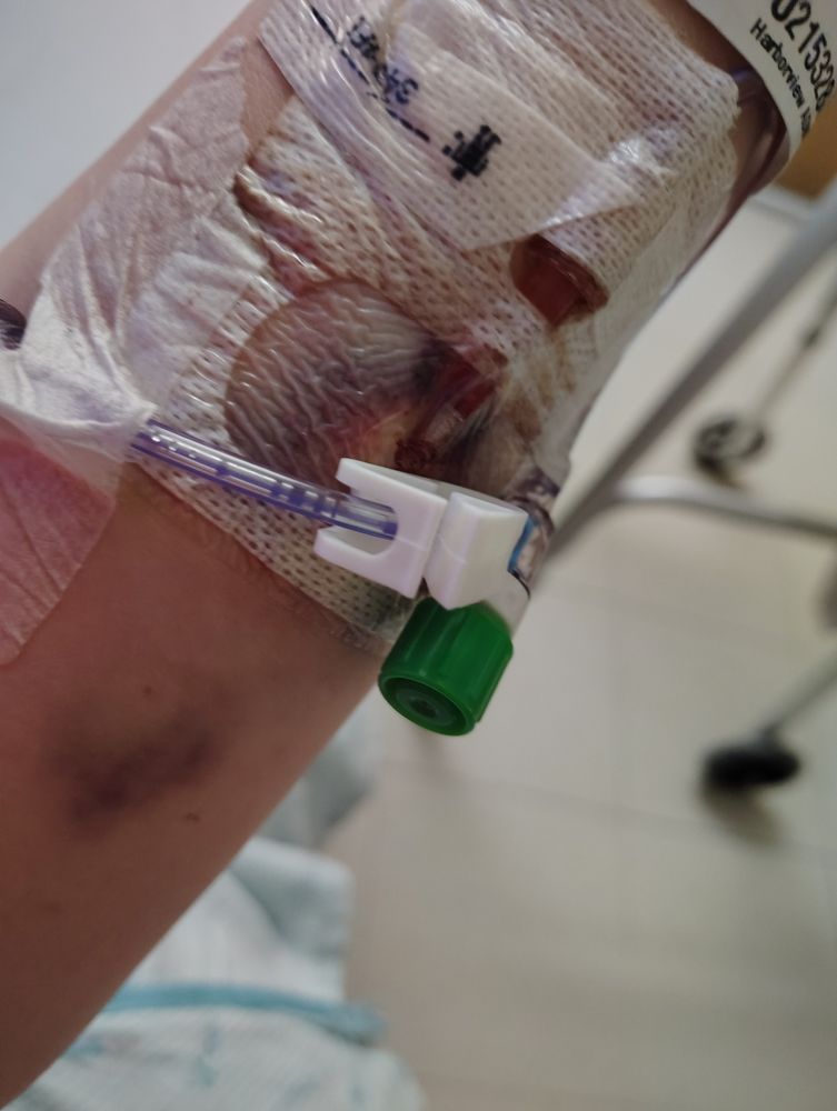 Spine Center Harborview Medical Center Uw Medicine - patient advocate in Seattle, WA