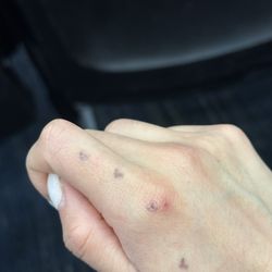 Live Tattoo - Almost healed