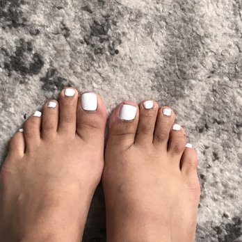 Lynn Today Nails - Crooked and uneven toe nails - Nail Salons Near Me - San Leandro, California Lynn Today Nails - Crooked and uneven toe nails - Nail Salons Near Me - San Leandro, California