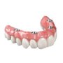 Mark's Dentures Lab