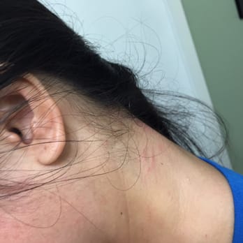 Spa Soleil Massage - Scratches on my neck from my masseuse - Day Spas Near Me - Venice, California