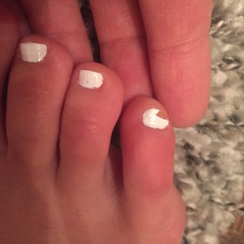 Nail By Young - Pedicure is 6 hours old and has chipped. And notice the "bubbles" too - Reflexology Near Me - New York, New York Nail By Young - Pedicure is 6 hours old and has chipped. And notice the "bubbles" too - Reflexology Near Me - New York, New York