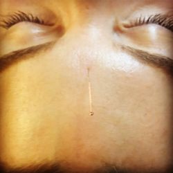 Mendocino Family Acupuncture