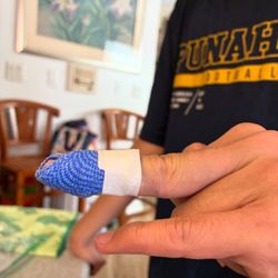 Reach Beyond Therapy - Custom made finger splint