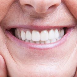Cain Denture Centers