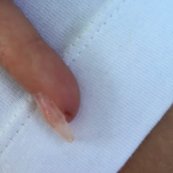 Fantasy Nails and Spa - Deep cut that stung every time I washed my hands - Nail Salons Near Me - Silver Spring, Maryland Fantasy Nails and Spa - Deep cut that stung every time I washed my hands - Nail Salons Near Me - Silver Spring, Maryland