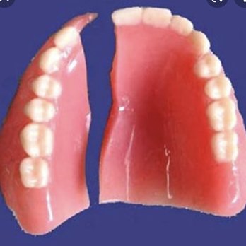 Flex Floss Dental Lab - We can bring this back to original! - Laboratory Testing Near Me - Morton Grove, Illinois Flex Floss Dental Lab - We can bring this back to original! - Laboratory Testing Near Me - Morton Grove, Illinois