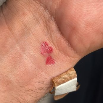 Kipik - My horrible tattoo from Kipic after just 10 days - Tattoo Near Me - Saint Tropez, 83