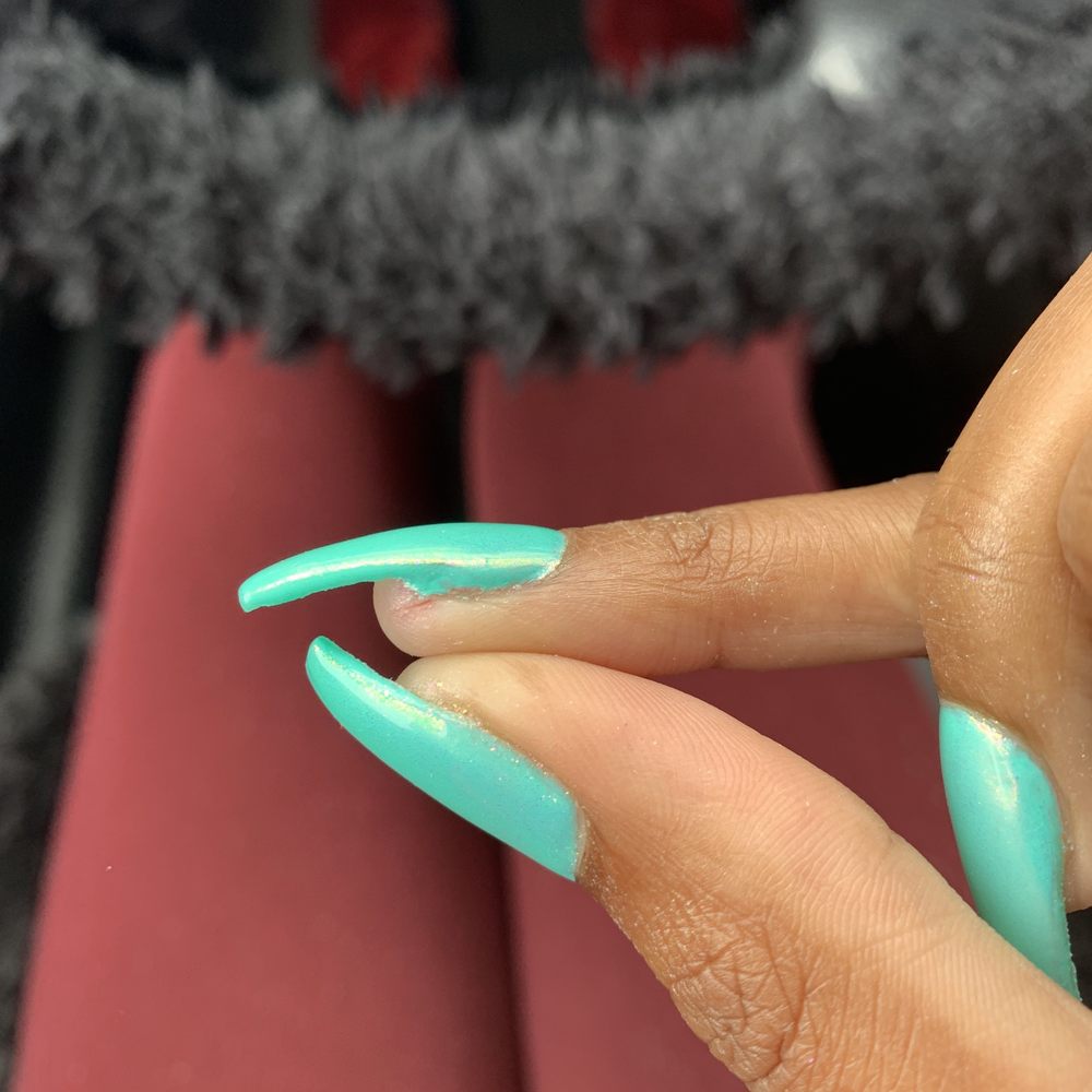 Cut finger Cut finger