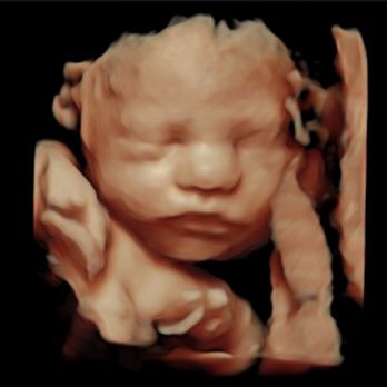 Sonohealth - 30 weeks! :) - Ultrasound Imaging Centers Near Me - San Diego, California Sonohealth - 30 weeks! :) - Ultrasound Imaging Centers Near Me - San Diego, California