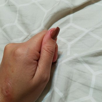 Diamond Nails & Spa - My left thumb. Filed horribly crooked and it hurts. - Nail Technicians Near Me - Fairfield, California